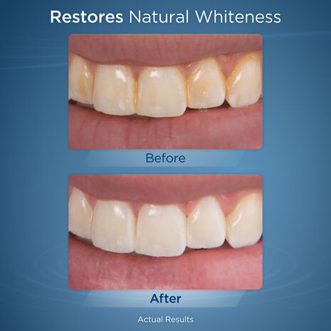 Whitening Tablets - 30pk